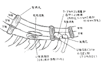 事故スケッチ図